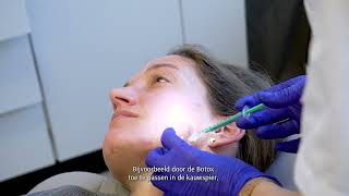 TREATMENT Confidence Booster® COLLAGEN amp Botox behandeling [upl. by Luca]