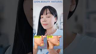 CHIN CORRECTION EXERCISE  Fix Protruding Chin Improve Chin Ptosis Witchs Chin [upl. by Deenya44]