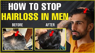 Best HAIR LOSS Treatments For Men Guaranteed Results [upl. by Alikee]