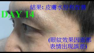 Philips Eye Brightener BSC301 Test and Result 眼部明亮按摩儀 14天測試結果 用左眼仔 舒服左 精靈左 [upl. by Akenahs904]