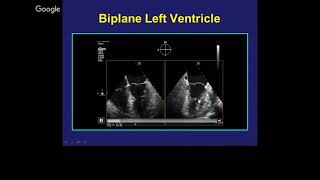 Echocardiography for Surgeons Part IV The Aortic Valve Other Structures and 3D Imaging [upl. by Lorenz285]