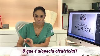 O que é Alopecia Cicatricial [upl. by Cirtemed]