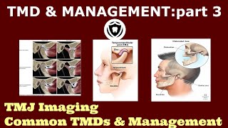 Temperomandibular Disorders amp ManagementPart 3 [upl. by Tabbi]