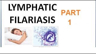 Parasitology 221 a Wuchereria Bancrofti Filariasis Filarial worm Elephantiasis Culex Microfilaria [upl. by Ahsrop]