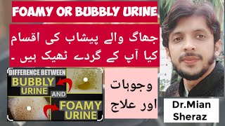 foamy urine vs normal urine [upl. by Acinor]