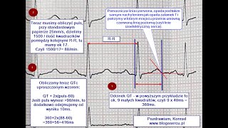 Prosty sposób obliczania QTc w EKG [upl. by Greenwood2]