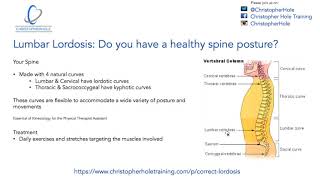 Lumbar lordosis Do you have a healthy spinal posture [upl. by Tila]