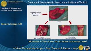 Microbiome Is There a New Way to Reduce Anastomotic Leaks [upl. by Muns130]