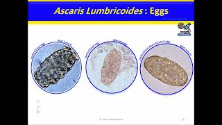 Ascaris lumbricoides Intestinal Nematode [upl. by Sapphire]