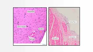 Histology of blood vessels and heart make it simple and easy MBBS program [upl. by Jule]