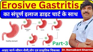 Erosive Gastritis Complete Diet Exercises and Treatmentdrramakantsharma7 [upl. by Latsyrcal]