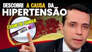 Como Achei a CAUSA da Hipertensão do Paciente no Exame de Sangue [upl. by Nassah921]