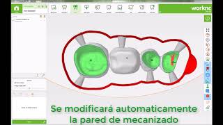 WorkNC Dental Novedades 2017 R2 [upl. by Kelley188]