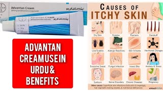 Advantan cream use in urdu amp benefits and side effects [upl. by Gemmell]