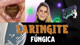 Laringite fúngica [upl. by Wesa863]