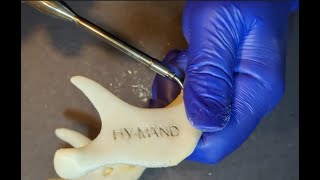 Englidh  Implant Bending for the correct angulation amp prosthetic perfection [upl. by Ati]