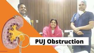 Successful Pyeloplasty done to correct PUJ obstruction  repair ureter  done by Dr Naresh Garg [upl. by Fahey345]