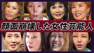 【衝撃画像】顔面崩壊した女性芸能人・有名人25選【※多重整形・整形失敗・事故】 [upl. by Aisanat]