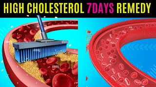 The Most Effective Way to Lower Your Cholesterol Naturally in 7 Days [upl. by Eleirbag]