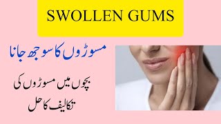 Home Remedies For Swollen Gums  مسوڑھوں کا سوجھ جانا [upl. by Dibbrun]