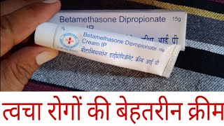 Betamethasone Dipropionate cream benefits and side effects [upl. by Chesnut]