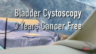 Bladder Cystoscopy Clean 3 years after bladder cancer May 2023 [upl. by Anastasio]