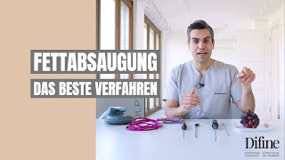 Vaser Liposuktion Erfahrung I Experte Dr Narwan erklärt wie bestmögliche Ergebnisse entstehen ✅ [upl. by Dylane]