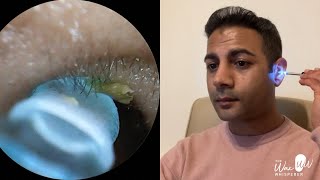 Watch me ‘attempt’ to clean my own ear using an online advertised ‘endoscope’ [upl. by Lynus]