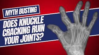 Is Knuckle Cracking Hurting Your Joints [upl. by Macmullin]