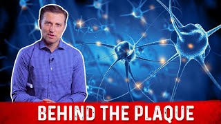 What is Plaque and How to Remove it Explained By Dr Berg [upl. by Johnathon]