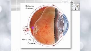 Vitreous anatomy and functions [upl. by Ffoeg547]