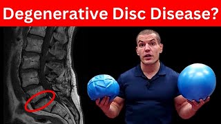 4 MustDo Exercises For Degenerative Discs In Lower Back Dont Skip These [upl. by Baerl]