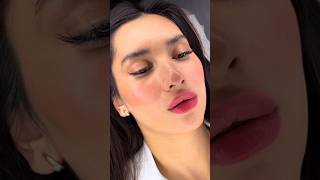 Вторичная контурная пластика губ 💉 Stylage M  0 8 ml 👄 filler косметология [upl. by Ennaeus]