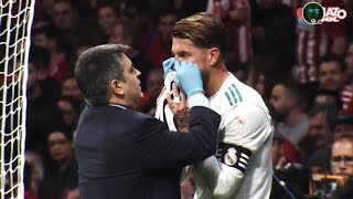 LOS DETALLES DE LA LESIÓN DE SERGIO RAMOS [upl. by Annirac]