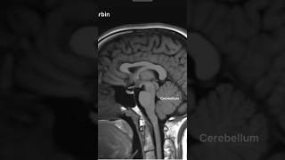 MRI Brain Anatomy medicalimaging mri mritech anatomy mribrainscan [upl. by Roz]