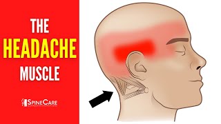 The Headache Muscle How to Release It for INSTANT RELIEF [upl. by Susanetta17]