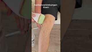 Narbenverklebungen lösen HolidaysWithYouTube [upl. by Lesya]