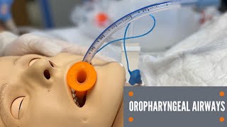 Oropharyngeal Airway Insertion [upl. by Norine]