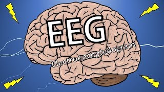 EEG టెస్ట్ అంటే ఏమిటి  What is Electro Encephalogram Test   Health Tips [upl. by Gant104]