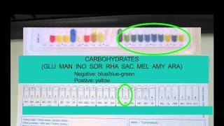 Microbiology Using API Strips 3 [upl. by Idnyl]