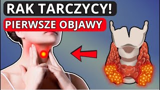 Twoja TARCZYCA krzyczy o PROBLEMACH Objawy które mogą prowadzić do poważnych konsekwencji [upl. by Nichani]