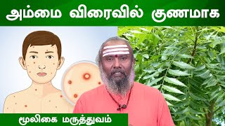 அம்மை விரைவில் குணமாக மூலிகை மருத்துவம்  Chicken Pox  Siddha Medicine  Treatment  Medical [upl. by Rim]