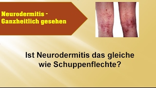 Ist Neurodermitis das gleiche wie Schuppenflechte  Ganzmedizin Naturheilpraxis [upl. by Kcinimod461]