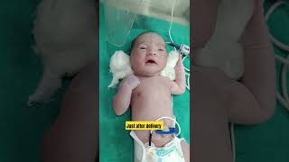 Newborn baby gruntingjust after delivery nicu icu baby cutebaby exercise cute [upl. by Voleta]