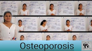 Osteoporosis Clinical Presentation Sinhala [upl. by Anaiad]