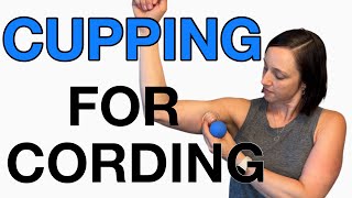 How to do CUPPING for CORDING after Breast Cancer Surgery Axillary Web Syndrome [upl. by Ahsinroc263]