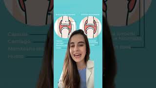 Diferencia entre artritis y artrosis 👩‍⚕️ curiosidades farmacia salud [upl. by Ytoc]