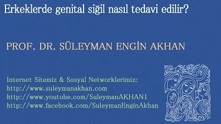 Erkeklerde genital siğil nasıl tedavi edilir  Prof Dr Süleyman Engin Akhan [upl. by Viridi]