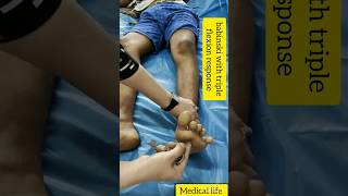 babinski with triple flexion response shorts medical aiims viral trending youtubeshorts [upl. by Lebama]