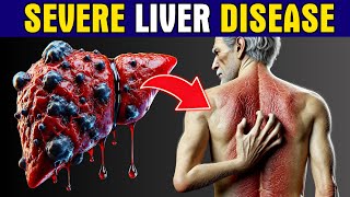 11 Strange Signs of LIVER DAMAGE Healthy Care [upl. by Anatniuq223]